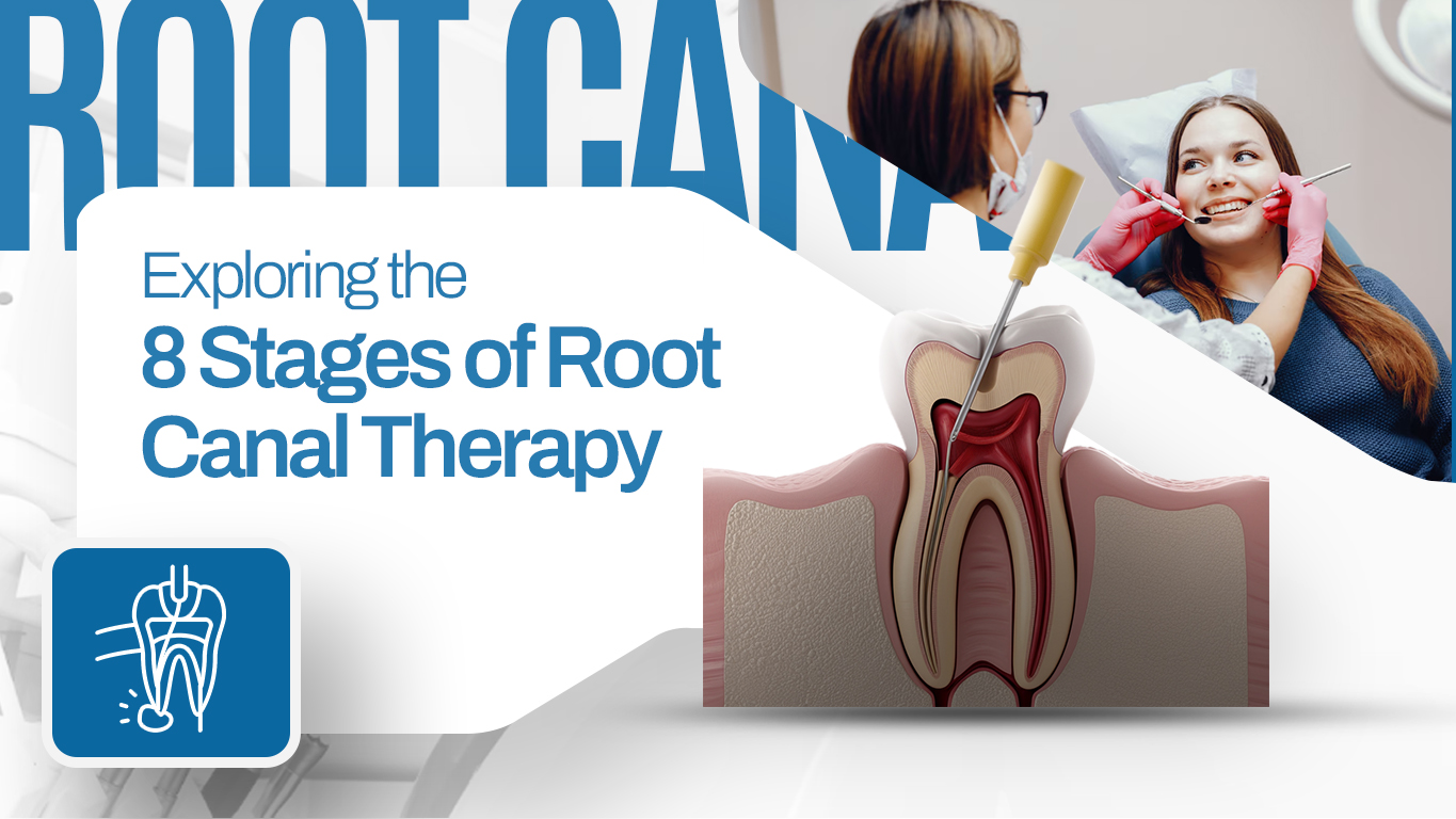 Root Canal Therapy